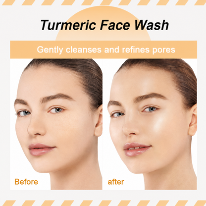 Turmeric Kojic Acid Cleanser – Brightening Acne Foam Cleanser