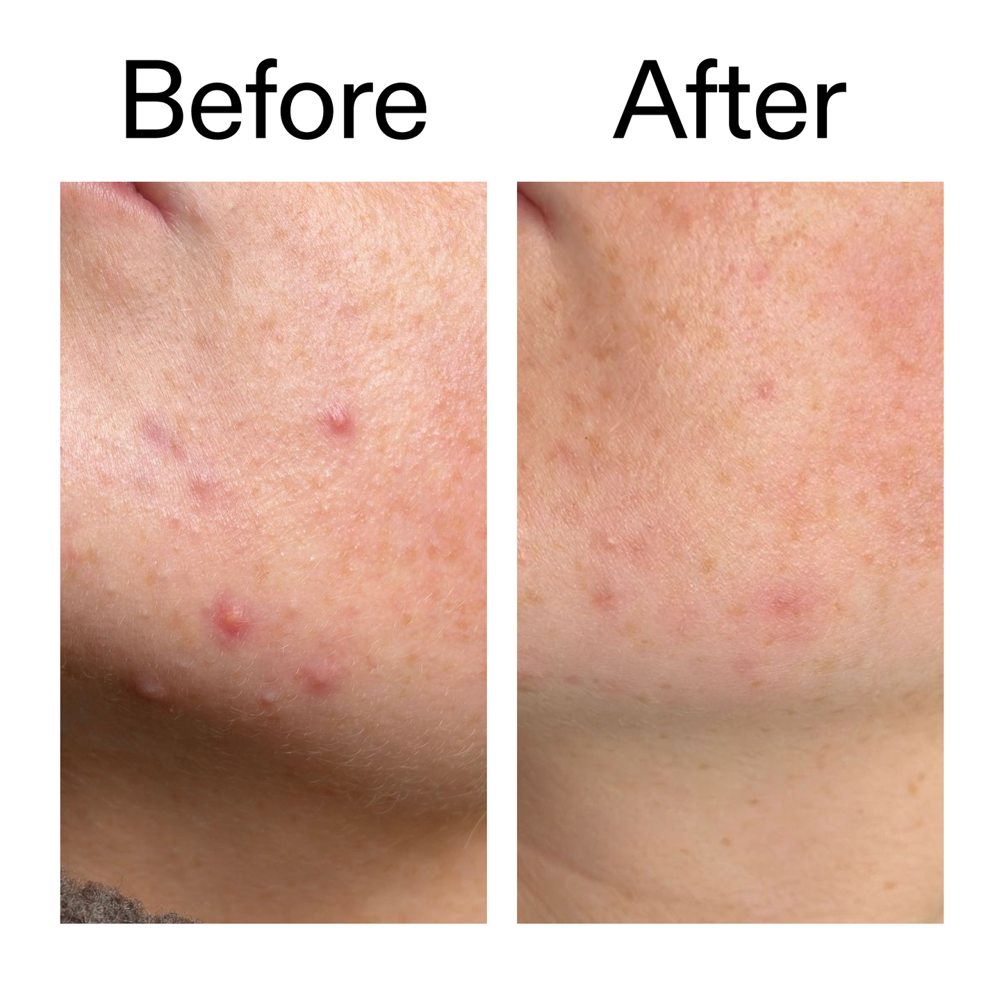 Glycolic Acid 7% Toning Solution