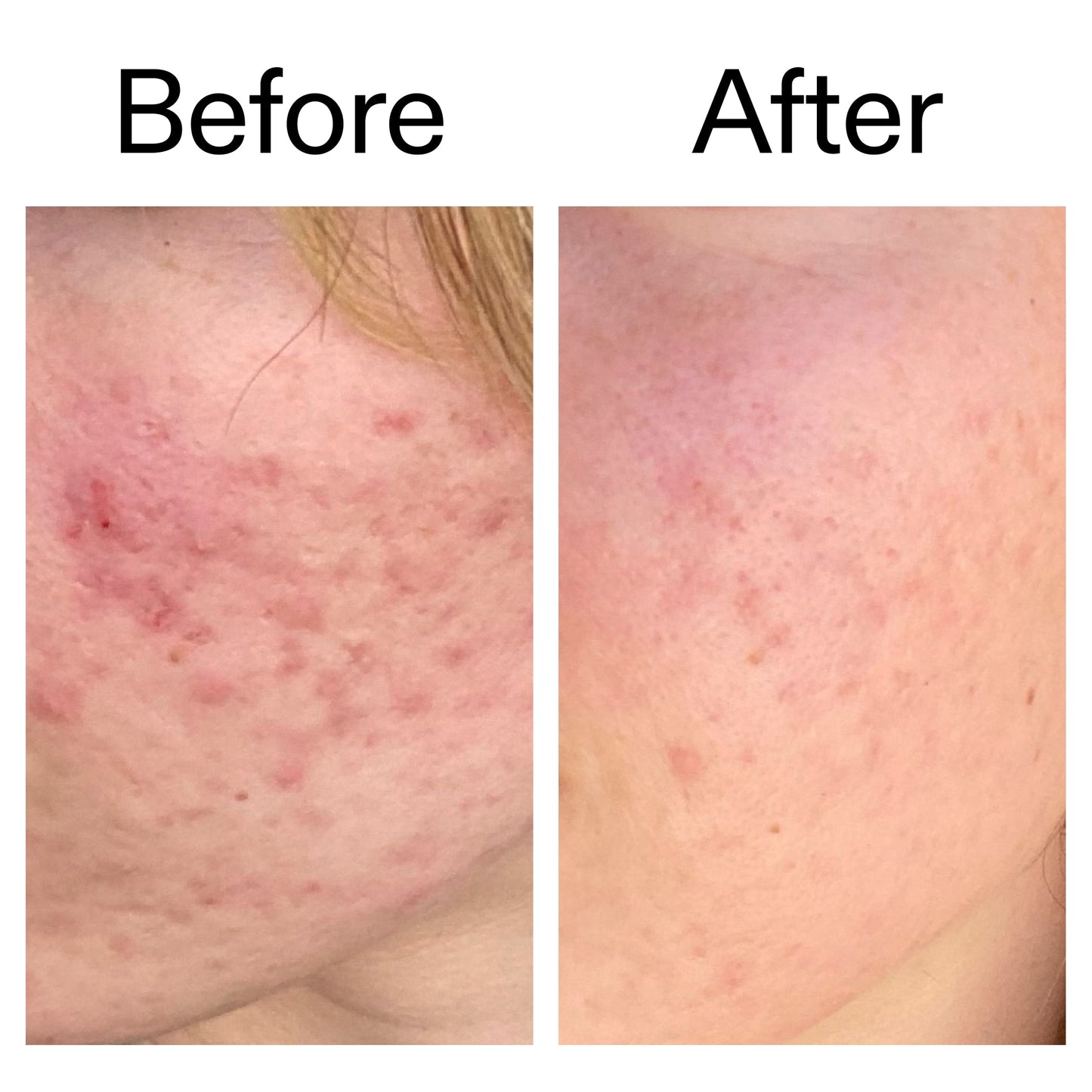Glycolic Acid 7% Toning Solution