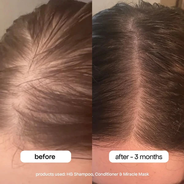 Glutathione 7 Serum Patch🌱