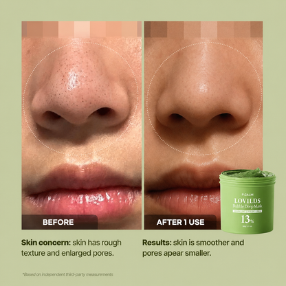 LAST DAY --BUY 1 GET 1FREE Bubble Deep Mask