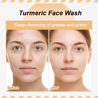 Turmeric Kojic Acid Cleanser – Brightening Acne Foam Cleanser